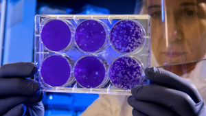 A collection of 6 petri dishes housing a blue liquid substance in each, encased in plastic, being observed by a doctor wearing a PPE face shield, dark-blue latex gloves, and a white lab coat.